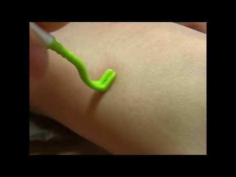 Tick Twister Trio - tick removal kit, 3 tick removers.